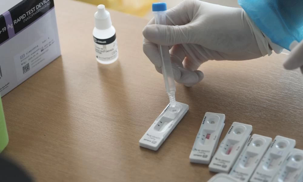 Υπ. Εργασίας: Διευκρινίσεις για την υποβολή υπεύθυνης δήλωσης επιχειρήσεων-εργοδοτών για rapid test